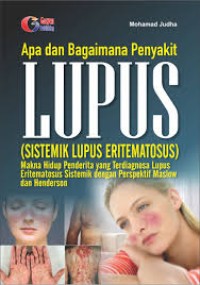Image of Apa dan Bagaimana Penyakit LUPUS (Sistemik Lupus Erimatosus)